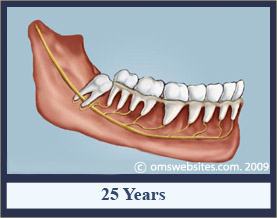 wisdomTooth_25years